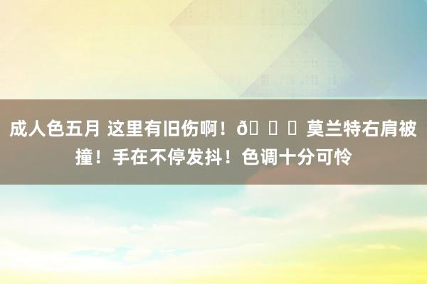 成人色五月 这里有旧伤啊！🙏莫兰特右肩被撞！手在不停发抖！色调十分可怜