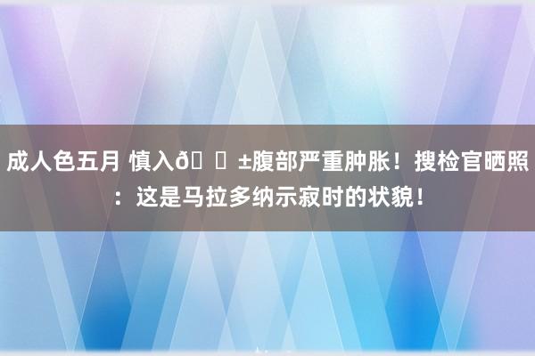 成人色五月 慎入😱腹部严重肿胀！搜检官晒照：这是马拉多纳示寂时的状貌！